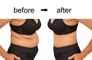 Woman's body before and after a weight loss program 